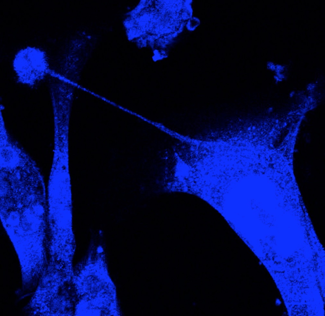 Immunofluorescence (IF) / fluorescent staining of MDA-MB-231 cells using EXOC1 Polyclonal antibody (11690-1-AP)