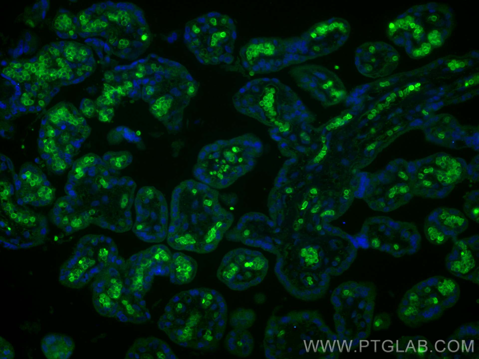 Immunofluorescence (IF) / fluorescent staining of human placenta tissue using EXOC1 Polyclonal antibody (11690-1-AP)