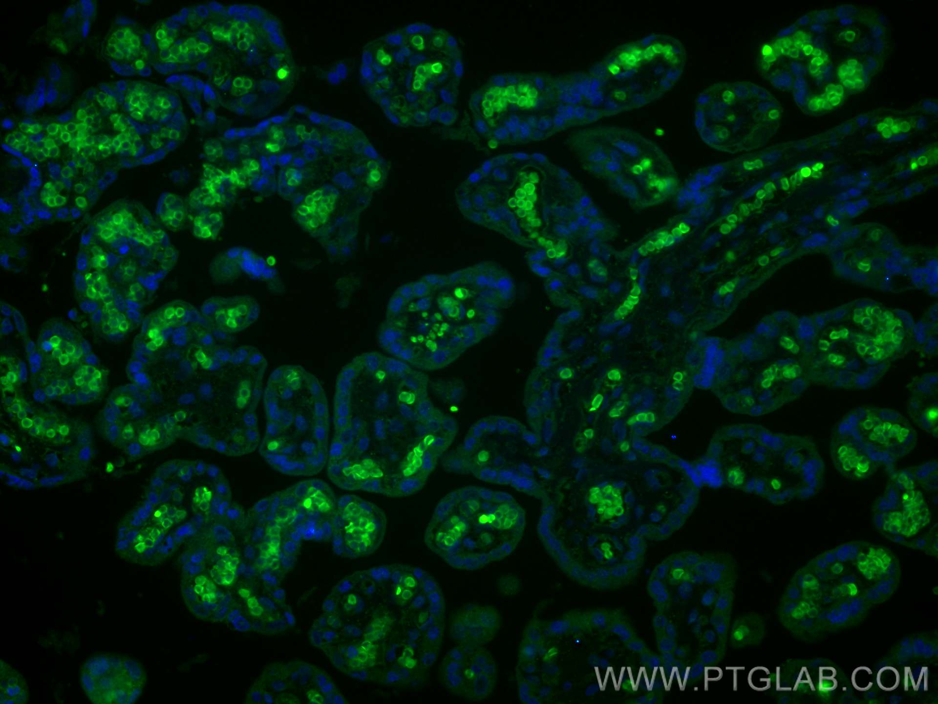 IF Staining of human placenta using 11690-1-AP