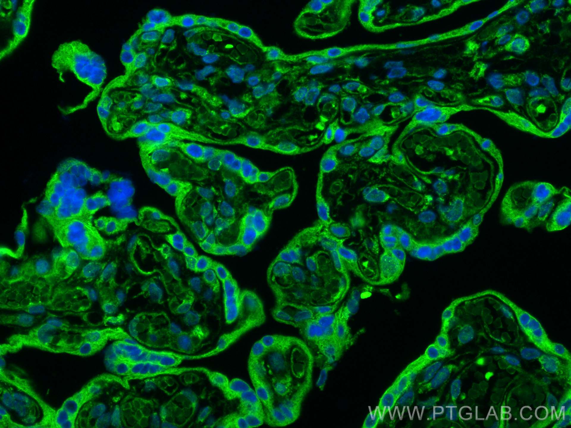 Immunofluorescence (IF) / fluorescent staining of human placenta tissue using EXOC1 Polyclonal antibody (11690-1-AP)