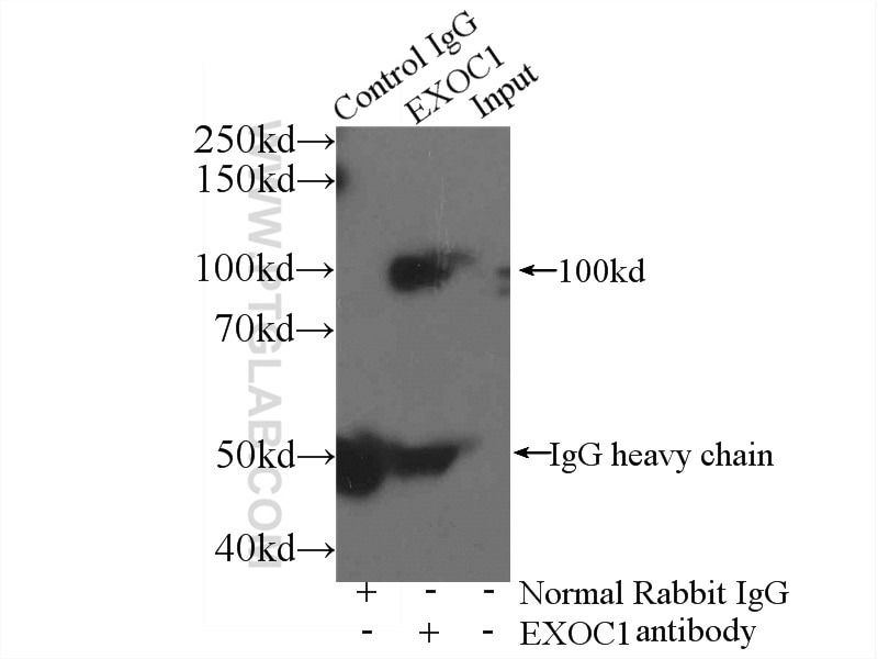 Immunoprecipitation (IP) experiment of mouse brain tissue using EXOC1 Polyclonal antibody (11690-1-AP)