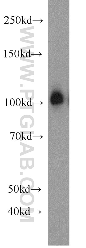 Western Blot (WB) analysis of rat brain tissue using EXOC1 Polyclonal antibody (11690-1-AP)