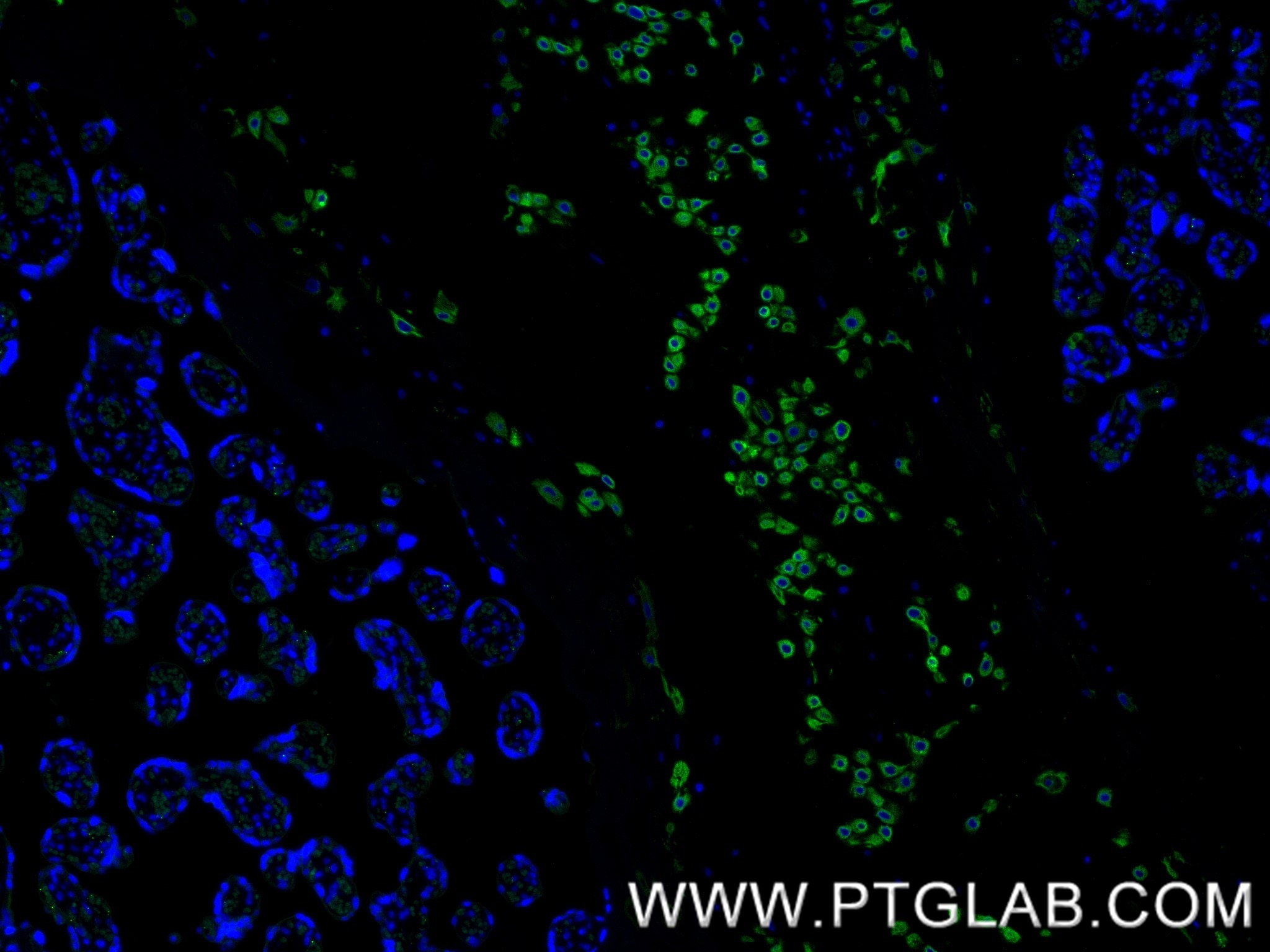 Immunofluorescence (IF) / fluorescent staining of human placenta tissue using EXOC1 Recombinant antibody (84007-5-RR)
