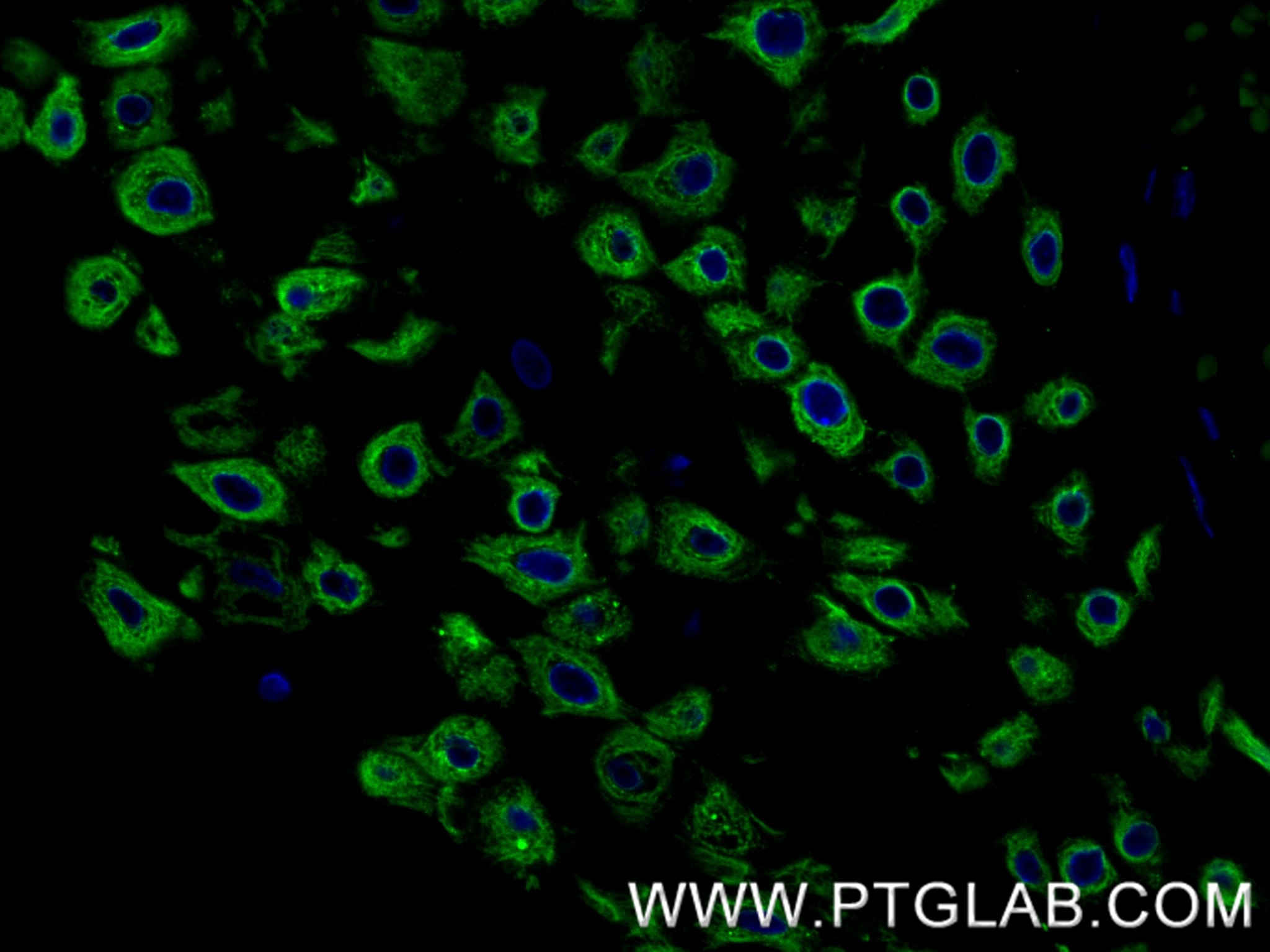 Immunofluorescence (IF) / fluorescent staining of human placenta tissue using EXOC1 Recombinant antibody (84007-5-RR)