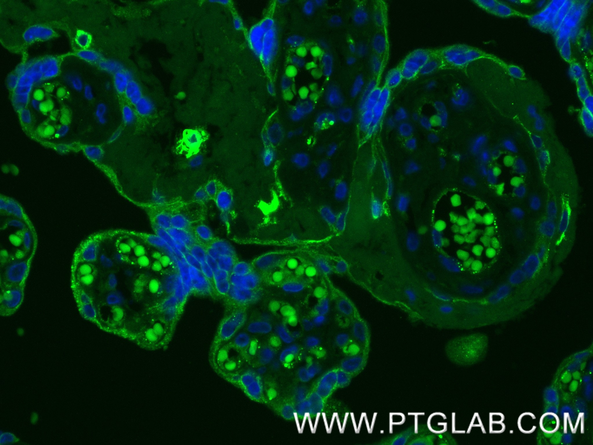 Immunofluorescence (IF) / fluorescent staining of human placenta tissue using EXOC1 Recombinant antibody (84007-5-RR)