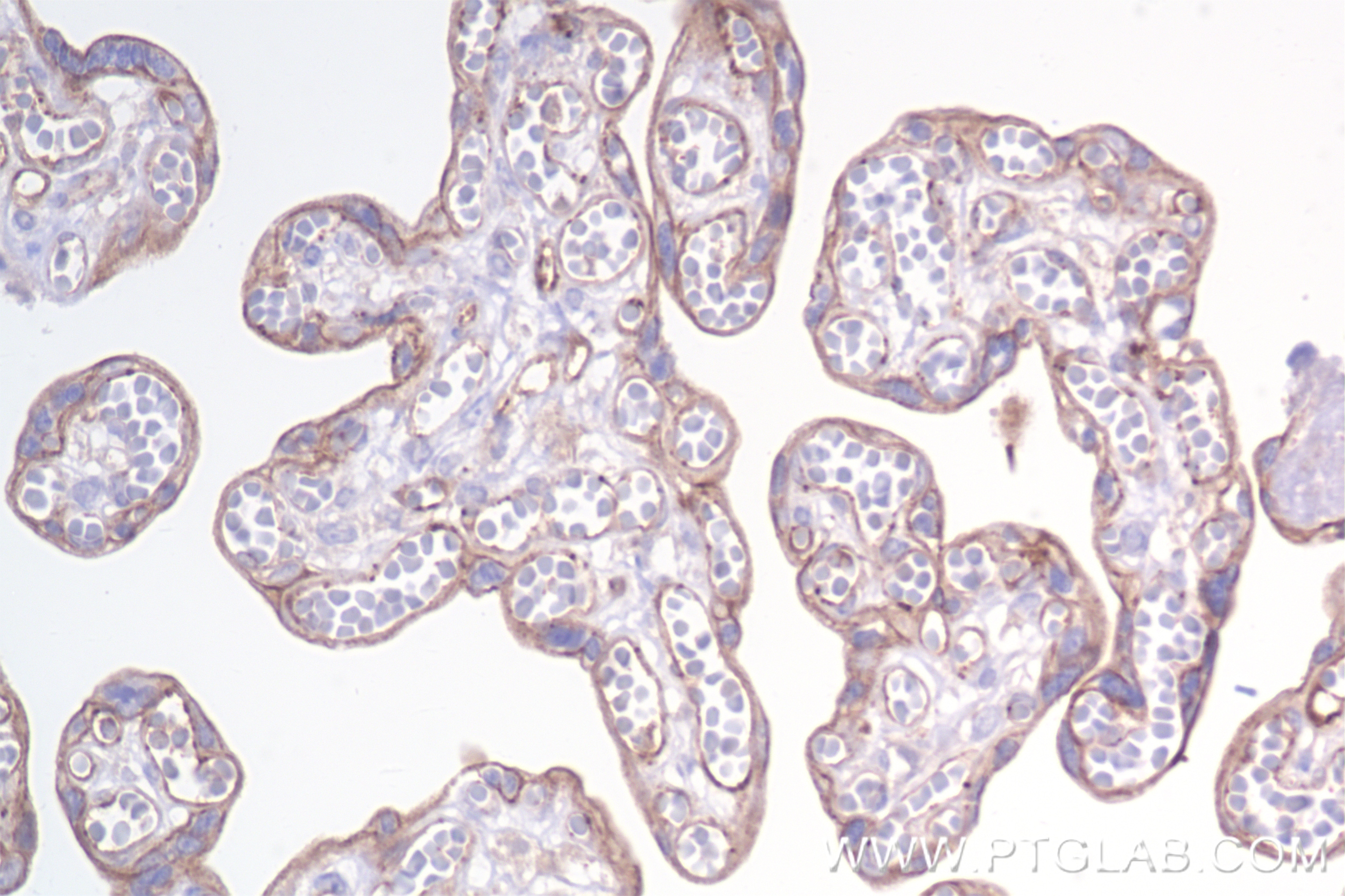 Immunohistochemistry (IHC) staining of human placenta tissue using EXOC1 Recombinant antibody (84007-5-RR)