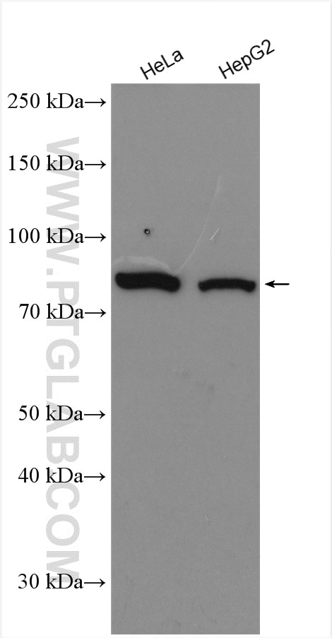 Western Blot (WB) analysis of various lysates using SEC6 Polyclonal antibody (14703-1-AP)