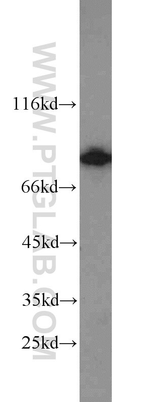 Western Blot (WB) analysis of HeLa cells using SEC6 Polyclonal antibody (14703-1-AP)