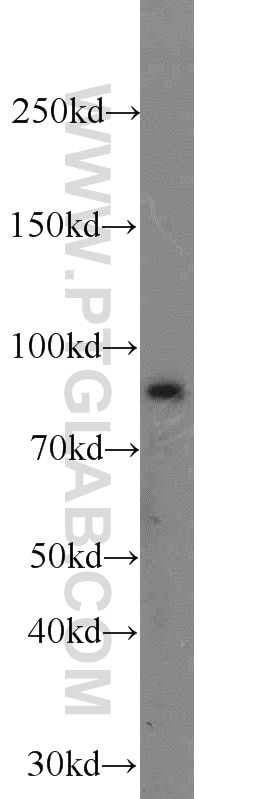 Western Blot (WB) analysis of COLO 320 cells using SEC6 Polyclonal antibody (14703-1-AP)