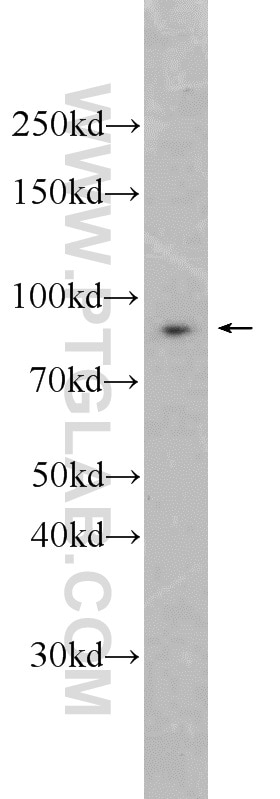 Western Blot (WB) analysis of HepG2 cells using SEC6 Polyclonal antibody (14703-1-AP)