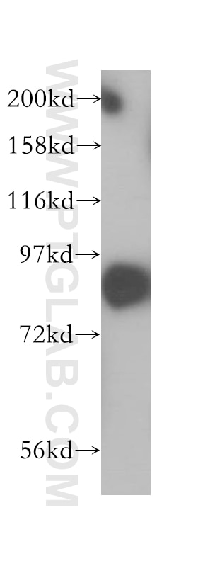 Western Blot (WB) analysis of human brain tissue using SEC6 Polyclonal antibody (14703-1-AP)