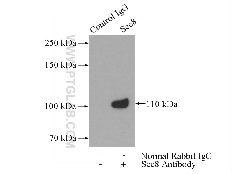 Immunoprecipitation (IP) experiment of Jurkat cells using Sec8 Polyclonal antibody (11913-1-AP)