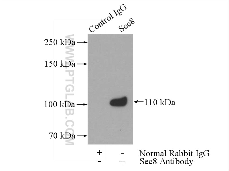 Sec8 Polyclonal antibody