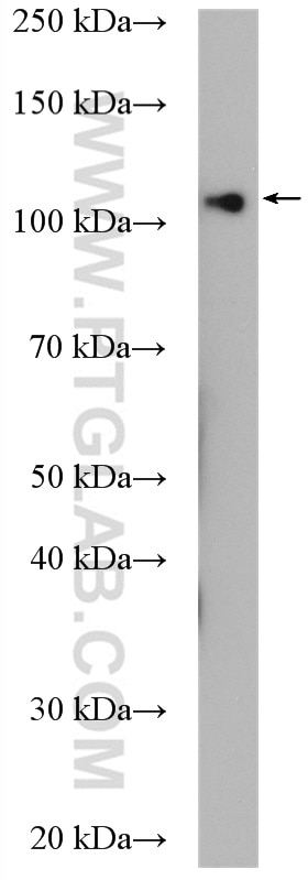 WB analysis of U-251 using 11913-1-AP