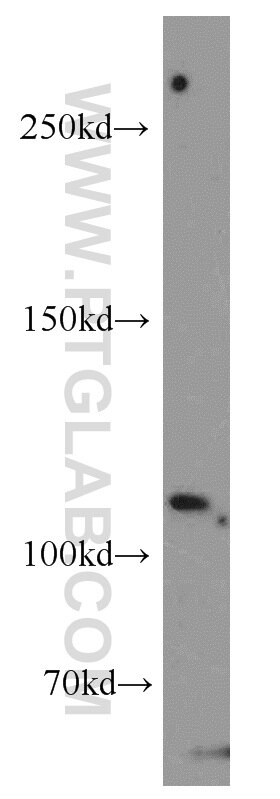 Western Blot (WB) analysis of Jurkat cells using Sec8 Polyclonal antibody (11913-1-AP)