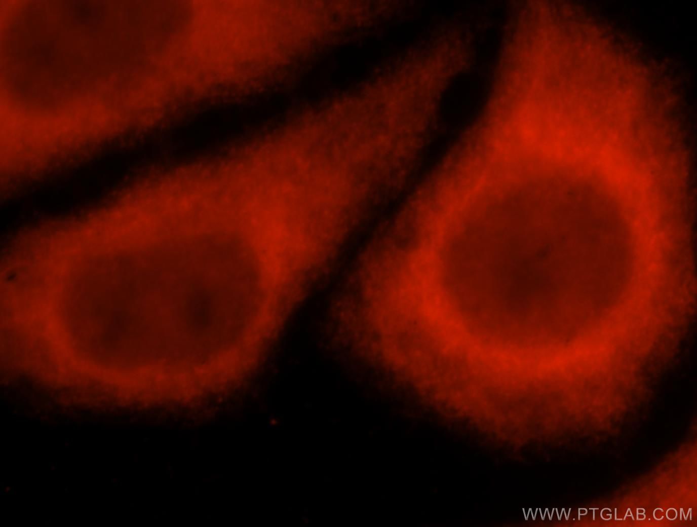 Immunofluorescence (IF) / fluorescent staining of HepG2 cells using EXOC5 Polyclonal antibody (17593-1-AP)