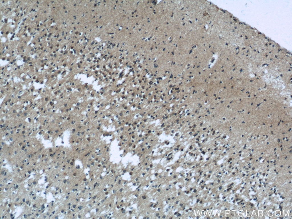 Immunohistochemistry (IHC) staining of human brain tissue using EXOC5 Polyclonal antibody (17593-1-AP)