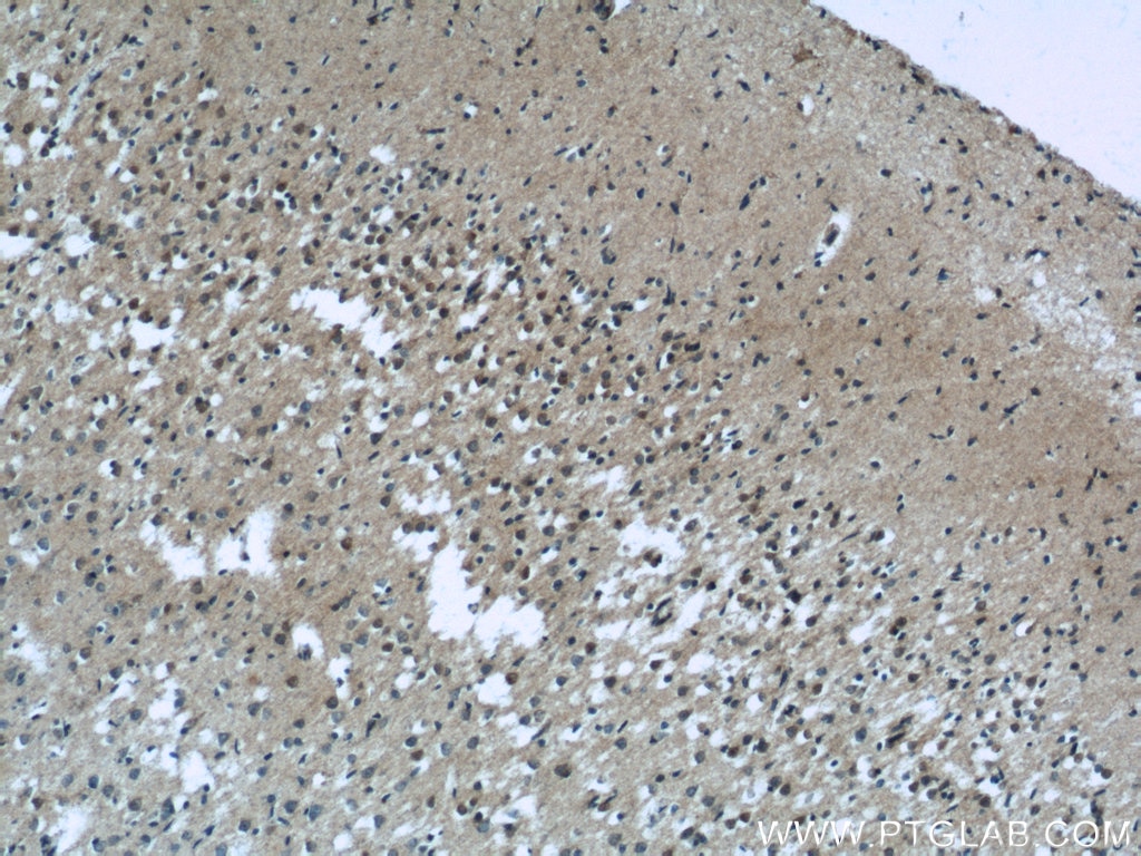 Immunohistochemistry (IHC) staining of human brain tissue using EXOC5 Polyclonal antibody (17593-1-AP)