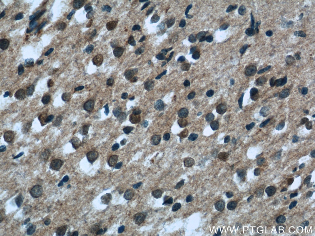 Immunohistochemistry (IHC) staining of human brain tissue using EXOC5 Polyclonal antibody (17593-1-AP)