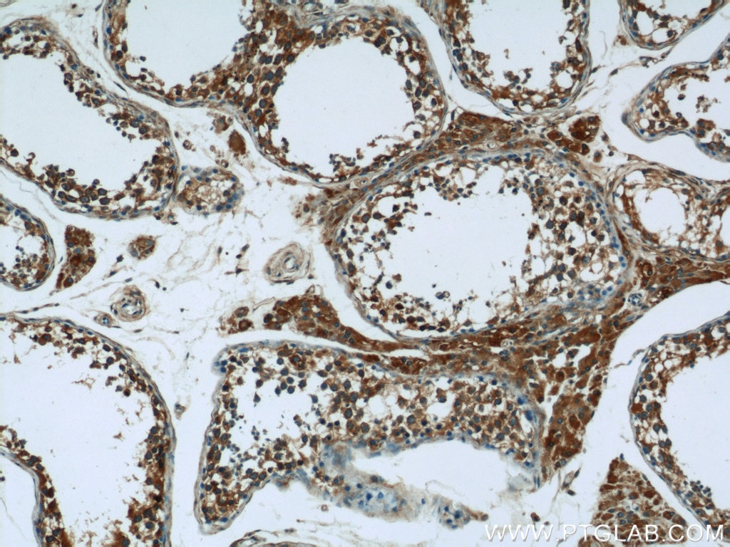 Immunohistochemistry (IHC) staining of human testis tissue using EXOC5 Polyclonal antibody (17593-1-AP)