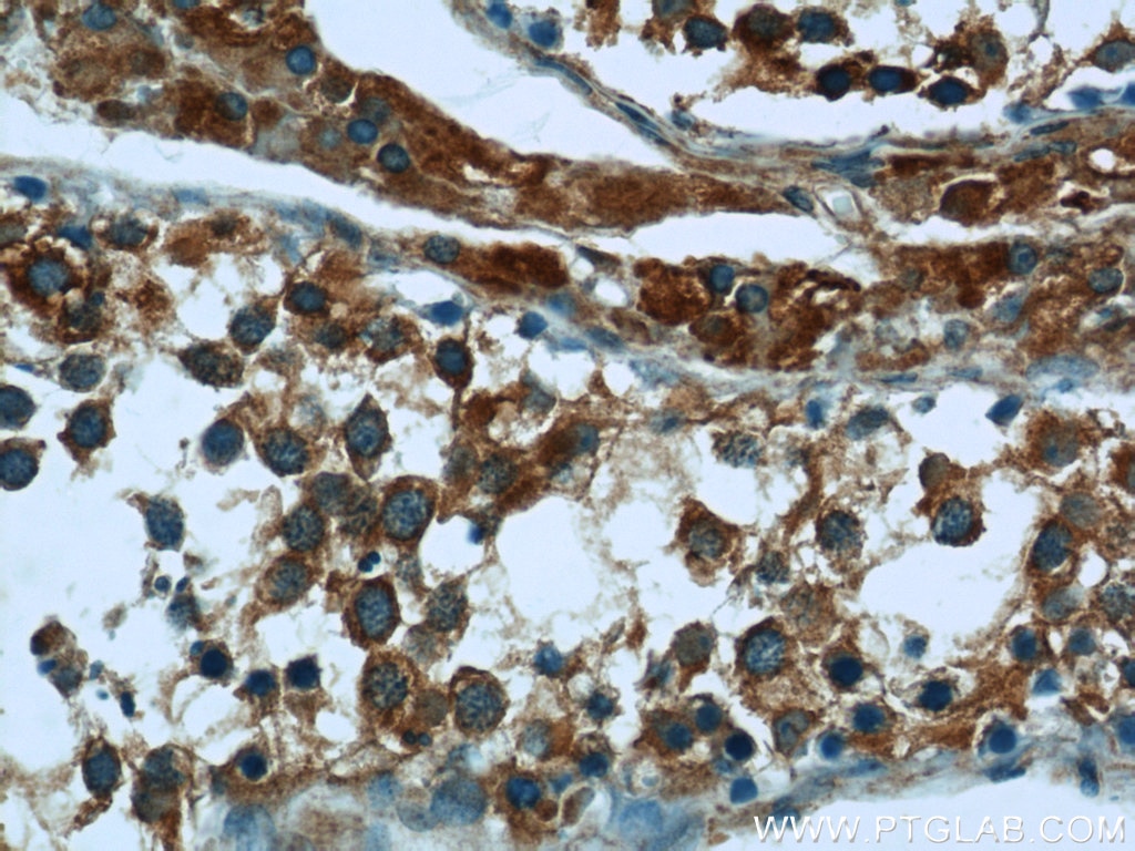 Immunohistochemistry (IHC) staining of human testis tissue using EXOC5 Polyclonal antibody (17593-1-AP)