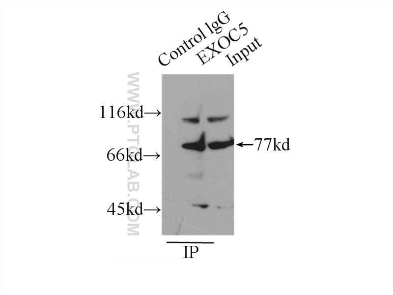 Immunoprecipitation (IP) experiment of mouse brain tissue using EXOC5 Polyclonal antibody (17593-1-AP)