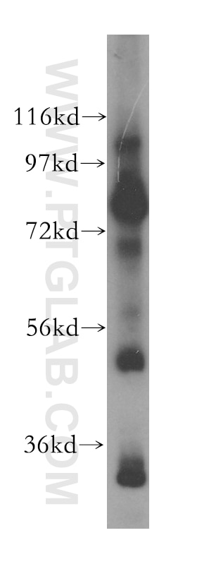 Western Blot (WB) analysis of mouse brain tissue using EXOC5 Polyclonal antibody (17593-1-AP)