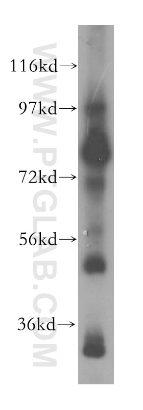 Western Blot (WB) analysis of human adrenal gland tissue using EXOC5 Polyclonal antibody (17593-1-AP)