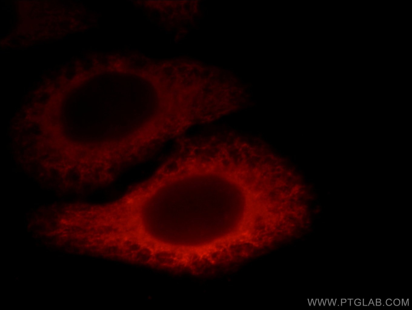 Immunofluorescence (IF) / fluorescent staining of HepG2 cells using EXOC6 Polyclonal antibody (12723-1-AP)