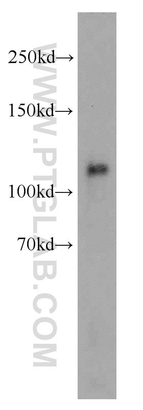 Western Blot (WB) analysis of human testis tissue using EXOC6 Polyclonal antibody (12723-1-AP)