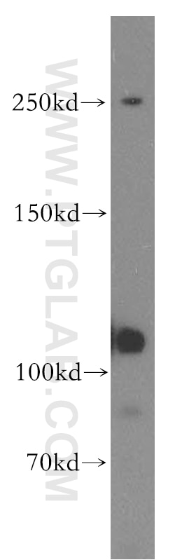 Western Blot (WB) analysis of human testis tissue using EXOC6 Polyclonal antibody (12723-1-AP)