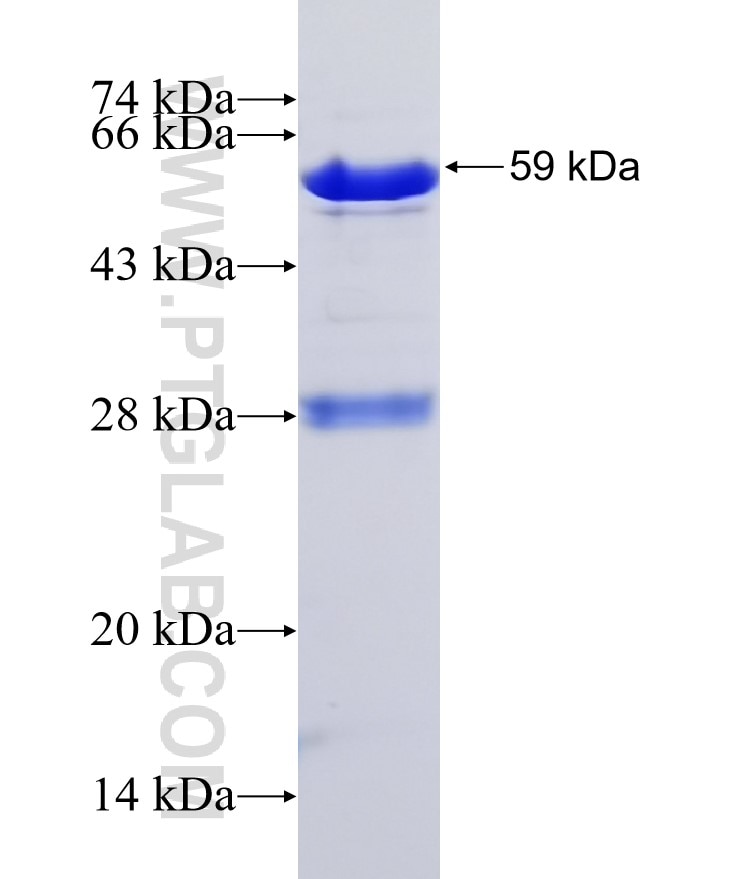 EXOC6 fusion protein Ag3418 SDS-PAGE