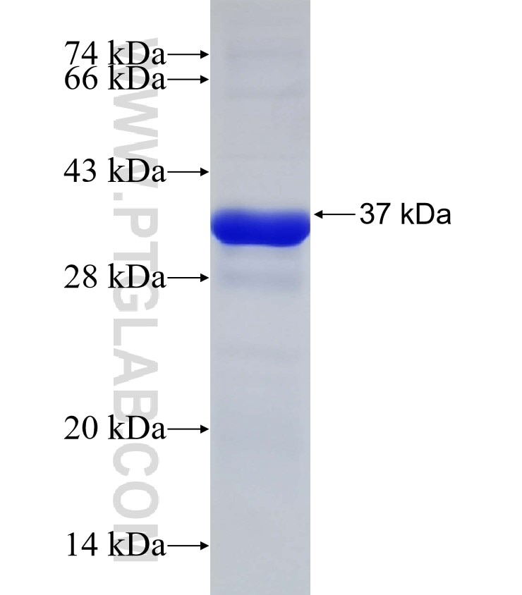 EXOC6 fusion protein Ag4391 SDS-PAGE