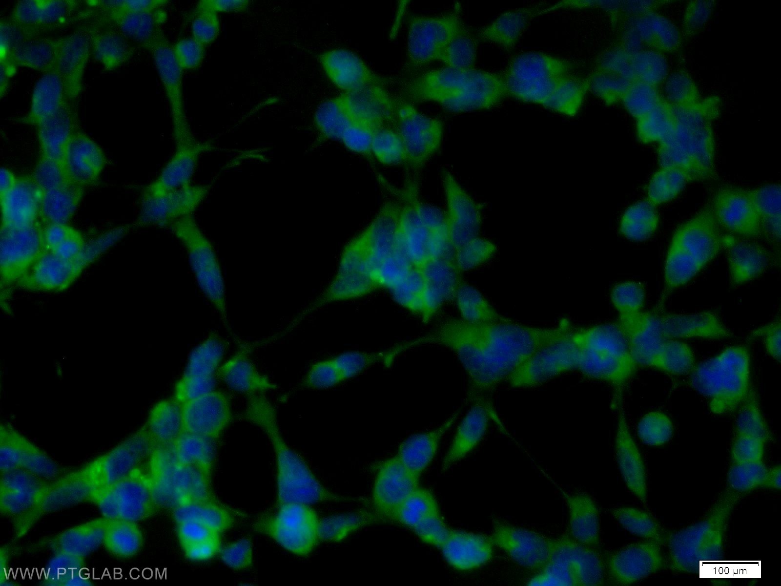 Immunofluorescence (IF) / fluorescent staining of HEK-293 cells using EXOC6B Polyclonal antibody (55440-1-AP)