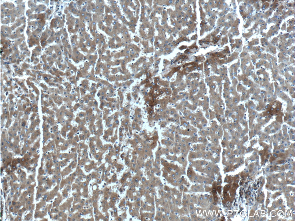 Immunohistochemistry (IHC) staining of human liver tissue using EXOC6B Polyclonal antibody (55440-1-AP)