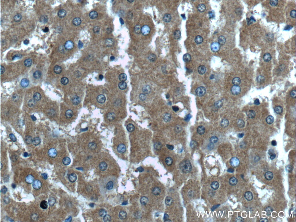 Immunohistochemistry (IHC) staining of human liver tissue using EXOC6B Polyclonal antibody (55440-1-AP)