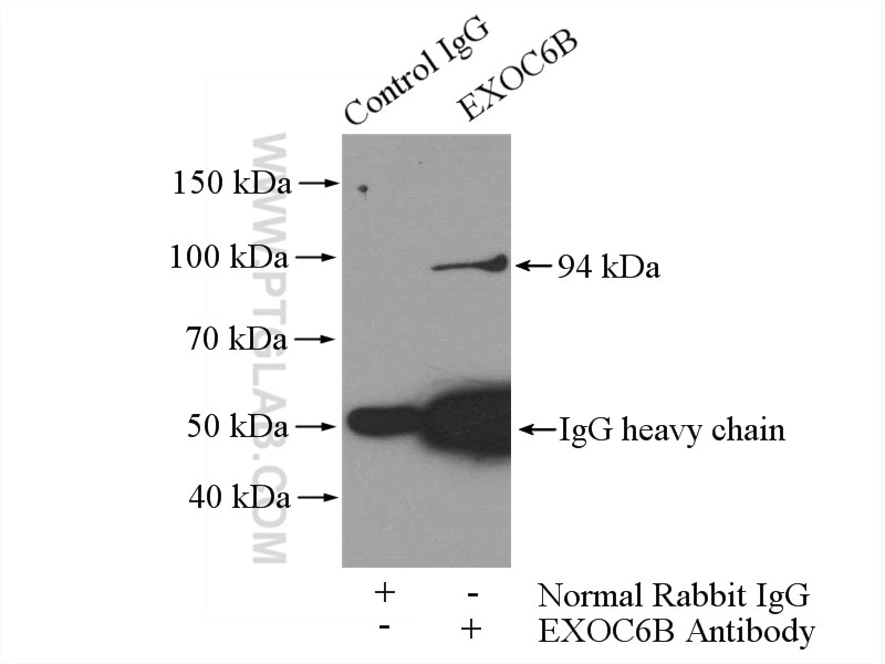 Immunoprecipitation (IP) experiment of HEK-293 cells using EXOC6B Polyclonal antibody (55440-1-AP)