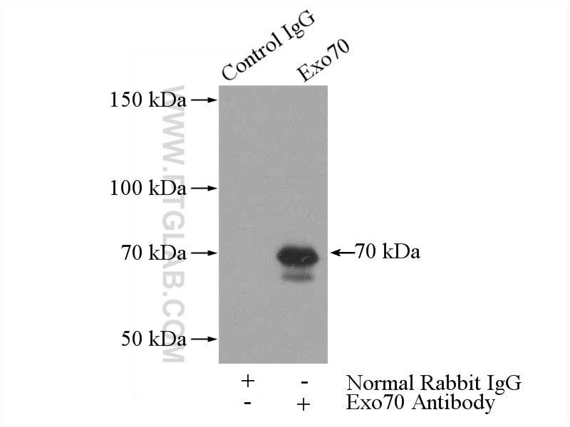 Immunoprecipitation (IP) experiment of mouse brain tissue using Exo70 Polyclonal antibody (12014-1-AP)