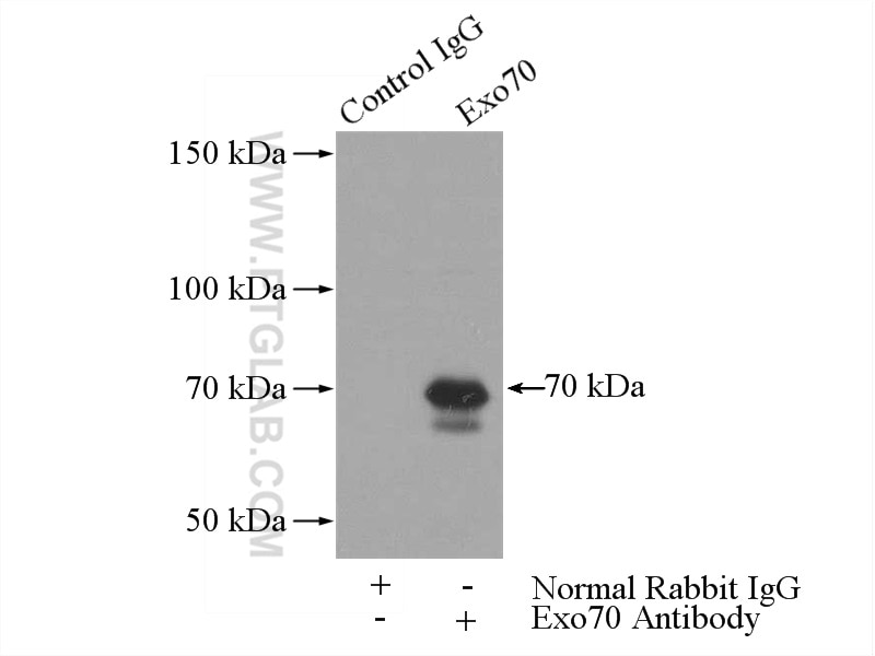 IP experiment of mouse brain using 12014-1-AP