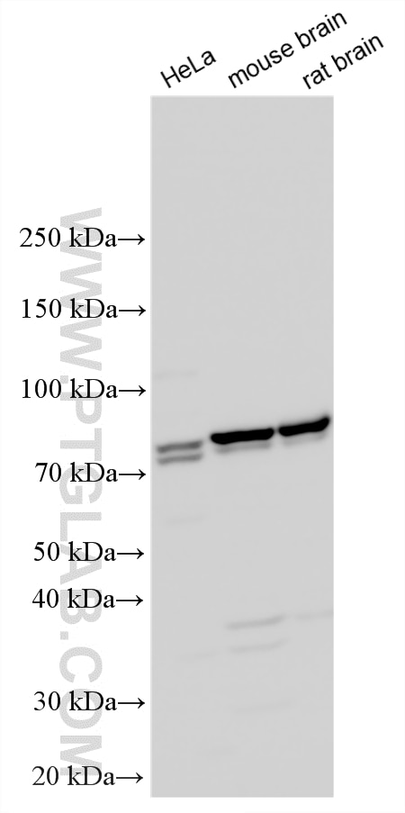 Various lysates were subjected to SDS PAGE followed by western blot with 12014-1-AP (Exo70 antibody) at dilution of 1:3000 incubated at room temperature for 1.5 hours. Western Blot (WB) analysis of various lysates using Exo70 Polyclonal antibody (12014-1-AP)