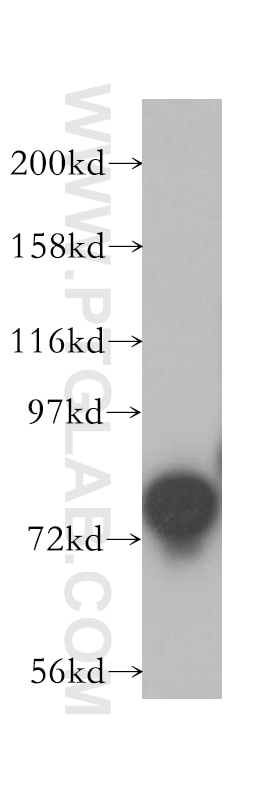 Western Blot (WB) analysis of human brain tissue using Exo70 Polyclonal antibody (12014-1-AP)