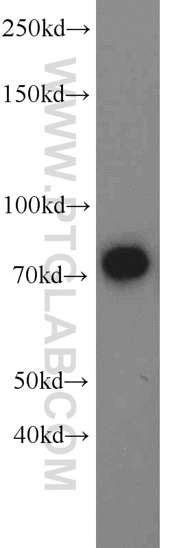 Western Blot (WB) analysis of mouse brain tissue using Exo70 Polyclonal antibody (12014-1-AP)