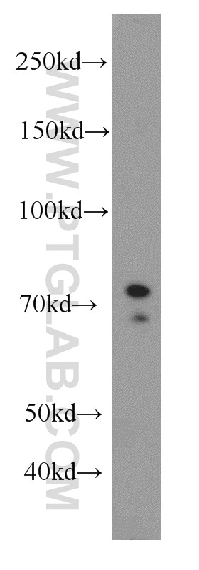 Western Blot (WB) analysis of HEK-293 cells using Exo70 Polyclonal antibody (12014-1-AP)