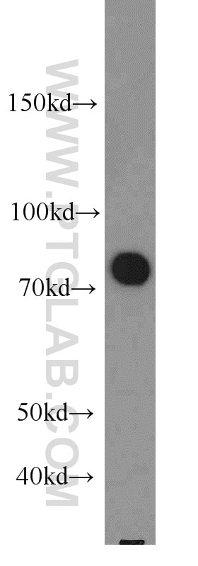 Western Blot (WB) analysis of human brain tissue using Exo70 Polyclonal antibody (12014-1-AP)