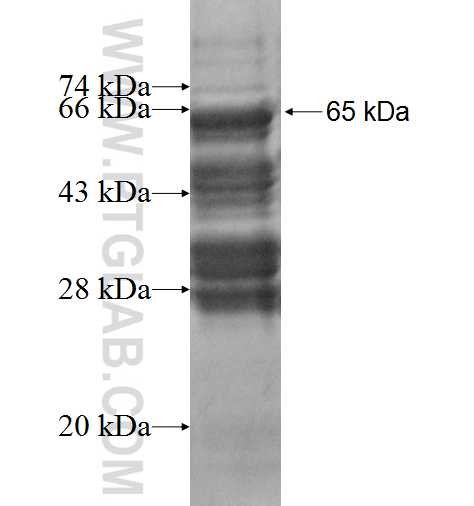 EXOC7 fusion protein Ag2628 SDS-PAGE