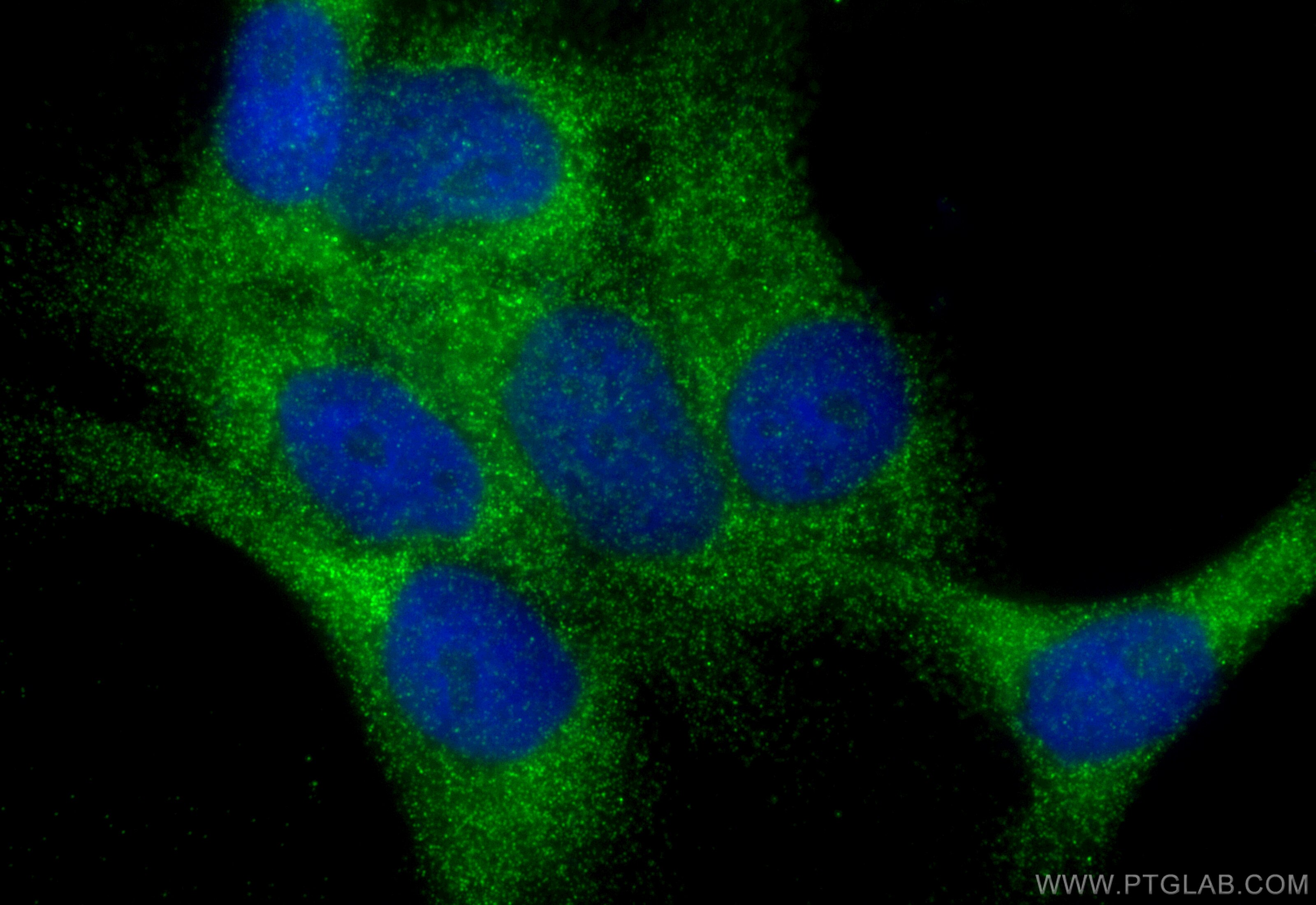 Immunofluorescence (IF) / fluorescent staining of A431 cells using EXOC8 Polyclonal antibody (31523-1-AP)