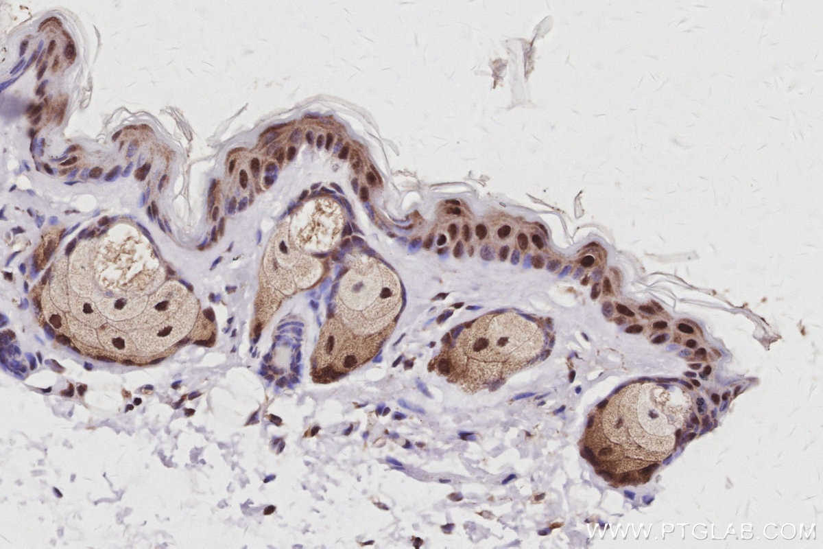 Immunohistochemistry (IHC) staining of mouse skin tissue using EXOSC1 Polyclonal antibody (12585-1-AP)