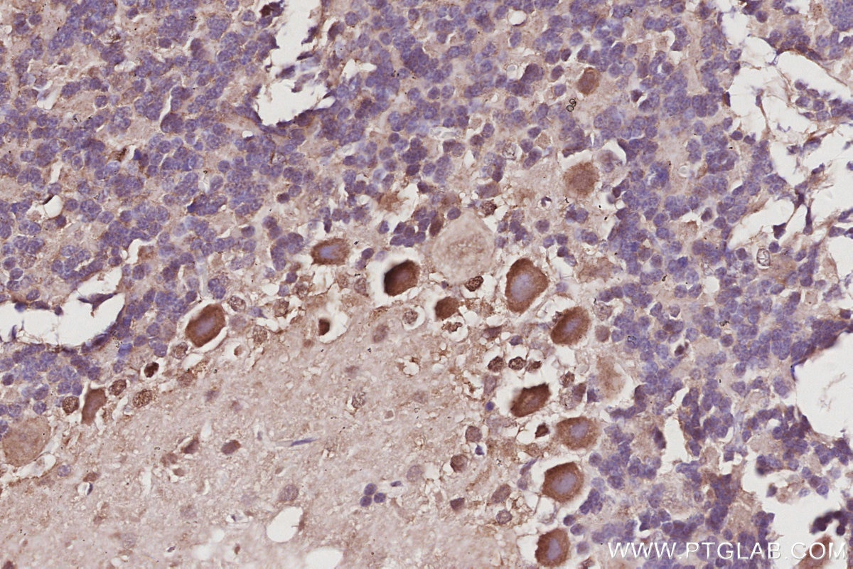 Immunohistochemistry (IHC) staining of rat cerebellum tissue using EXOSC1 Polyclonal antibody (12585-1-AP)