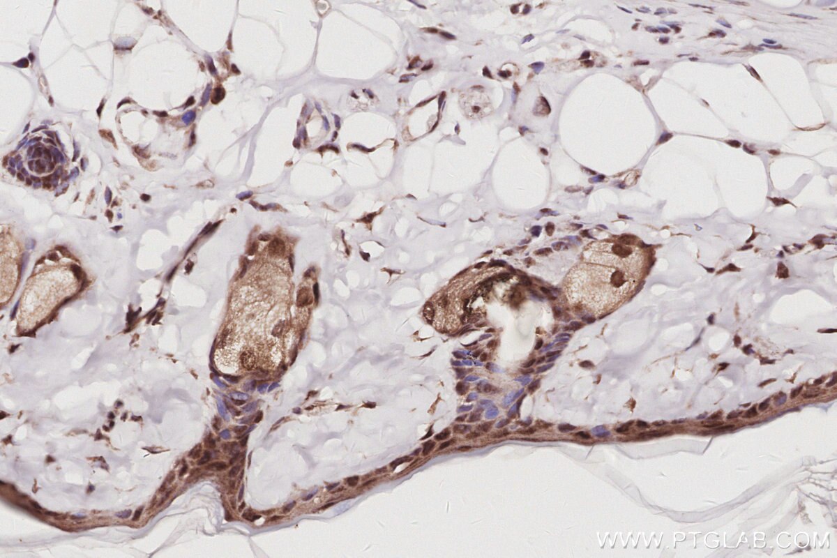 Immunohistochemistry (IHC) staining of rat skin tissue using EXOSC1 Polyclonal antibody (12585-1-AP)