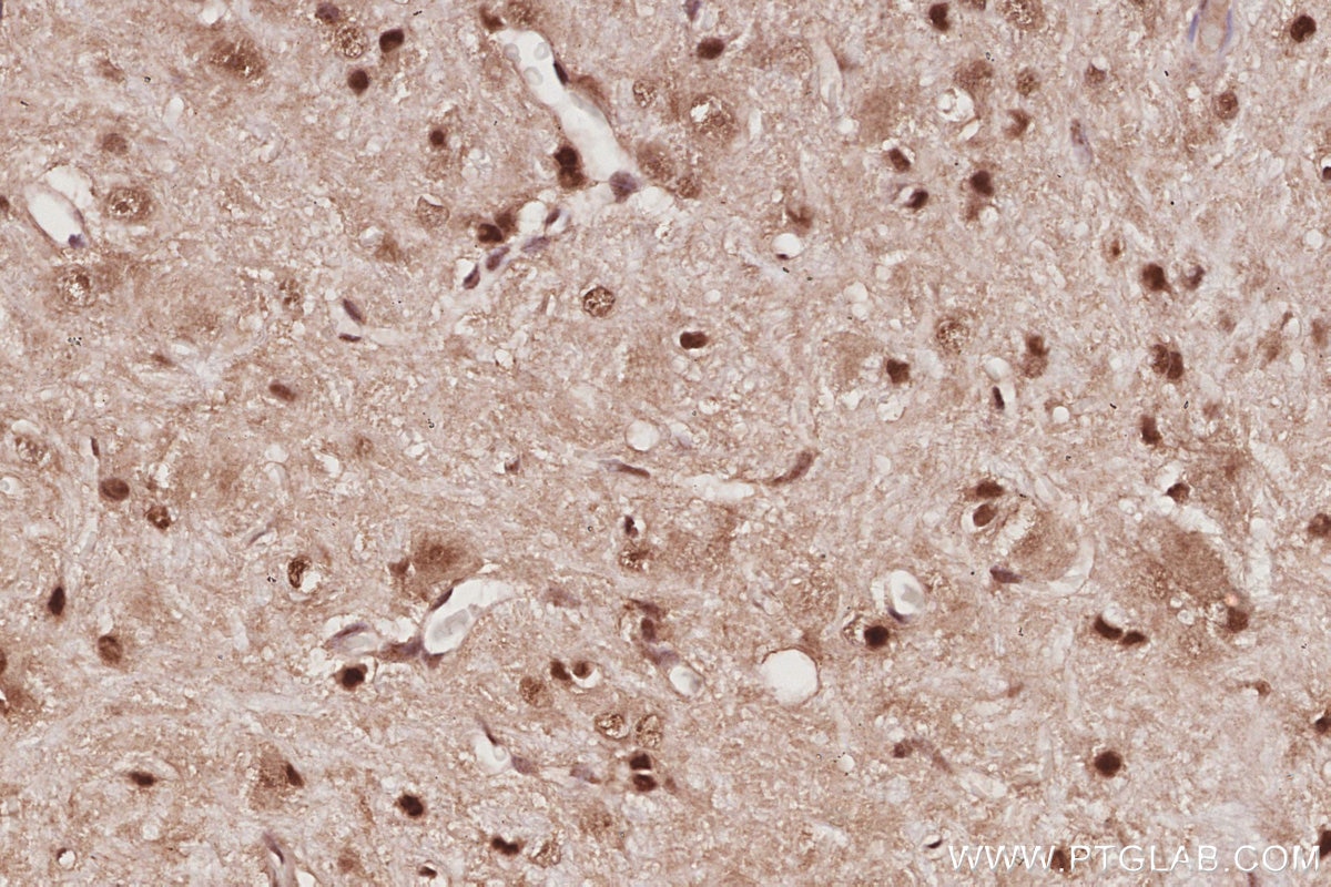 Immunohistochemistry (IHC) staining of rat cerebellum tissue using EXOSC1 Polyclonal antibody (12585-1-AP)